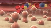 Hematologic Malignancies: New Therapies and the Evolving Role of Transplant